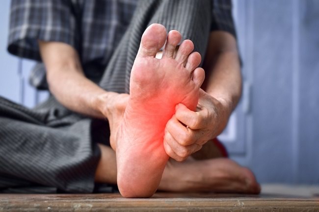 Kesemutan dan Kebas Kaki? Waspadai Saraf Kejepit dan Lakukan Terapi Alami di Jogja