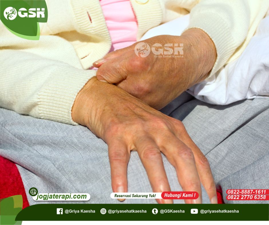 Terapi untuk Stroke Iskemik: Solusi Alami dan Holistik yang Aman