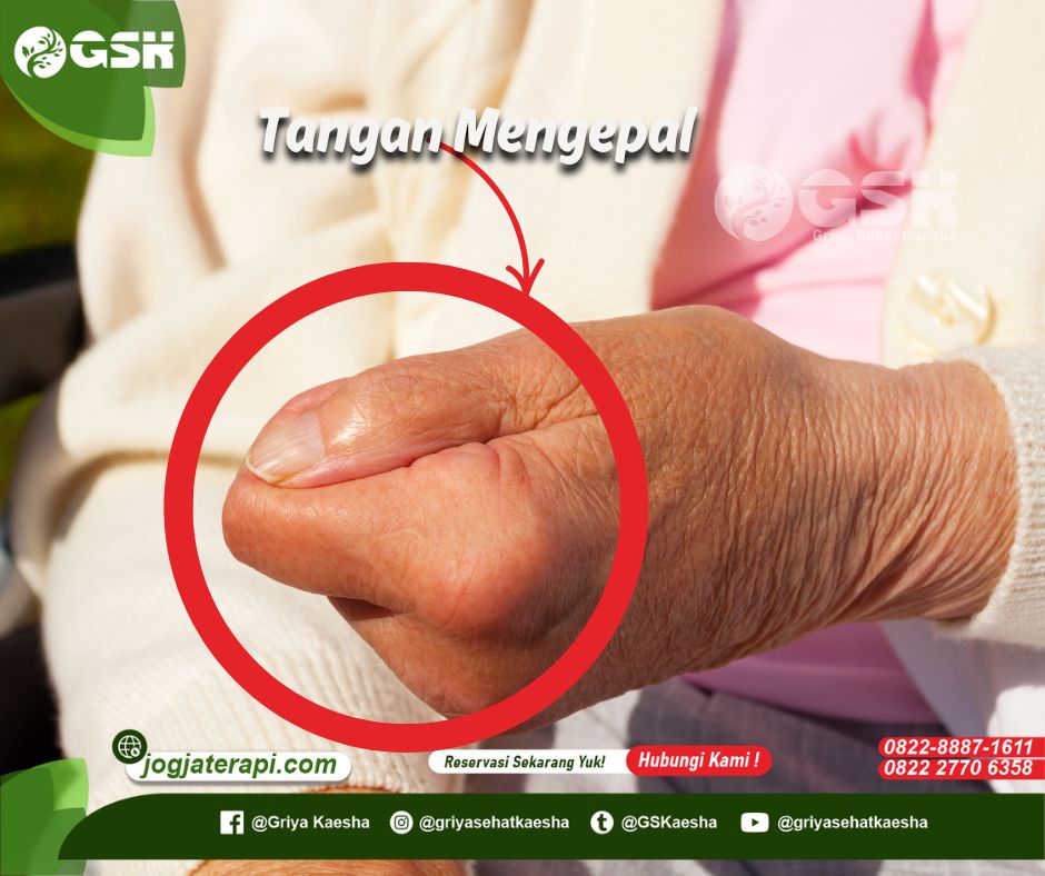 Terapi Stroke Alami Jogja – Solusi Pemulihan Tanpa Obat dan Operasi di Griya Sehat Kaesha