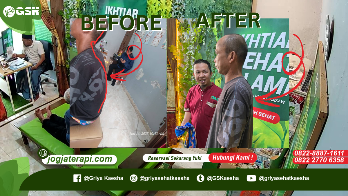Sakitnya Bukan Main: Syaraf Kejepit Gara-Gara Motong Hewan Kurban